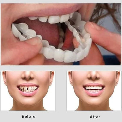 Silicone Teeth Cover